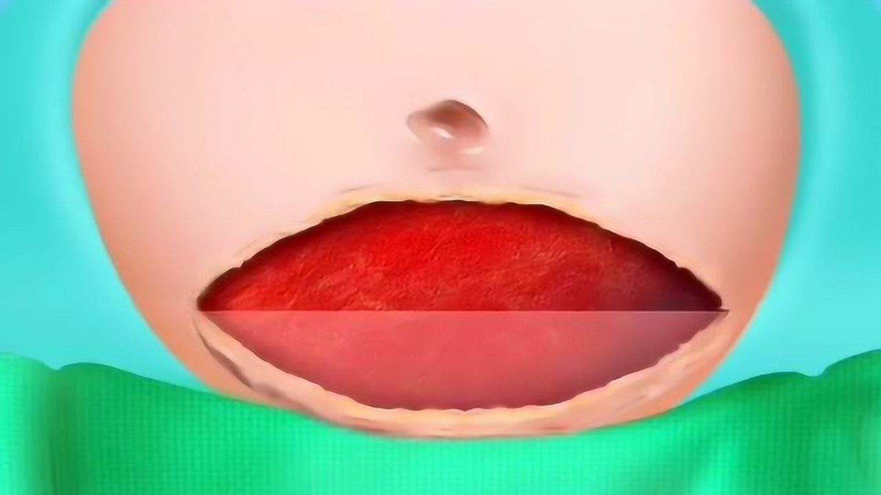 顺产vs剖宫产到底哪个好,剖宫产和顺产哪个好得快