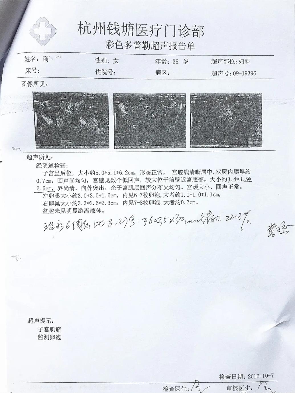 子宫肌瘤10厘米中医医案,国医大师治子宫肌瘤方剂