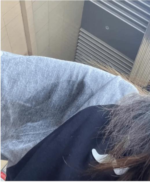 狐臭止汗露推荐不显黑,狐臭止汗露推荐真实测评怎么用