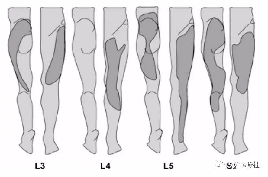 腰椎间盘突出症的治疗方法,腰椎间盘突出症状主要有哪些