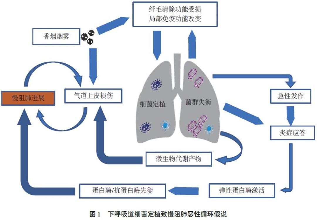 周敏教授：慢阻肺病、支扩及慢阻肺支扩重叠综合征气道微生物研究