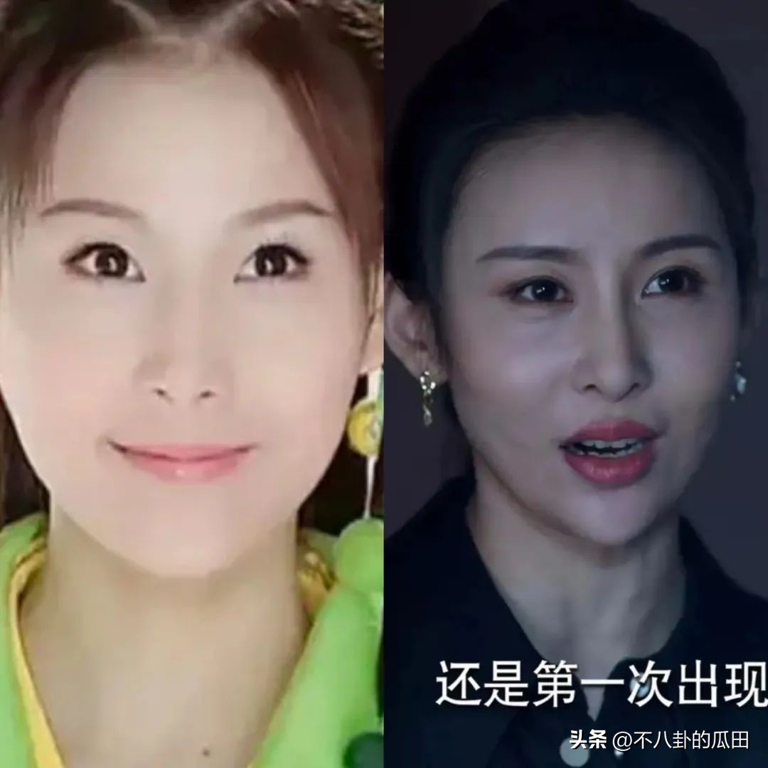 蔡徐坤下巴太尖惹争议图片,蔡徐坤下巴是假体吗