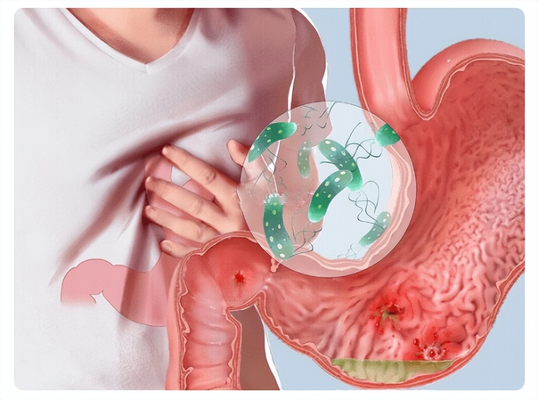 甲硝唑4块一瓶管用吗,甲硝唑几块钱一瓶的靠谱吗