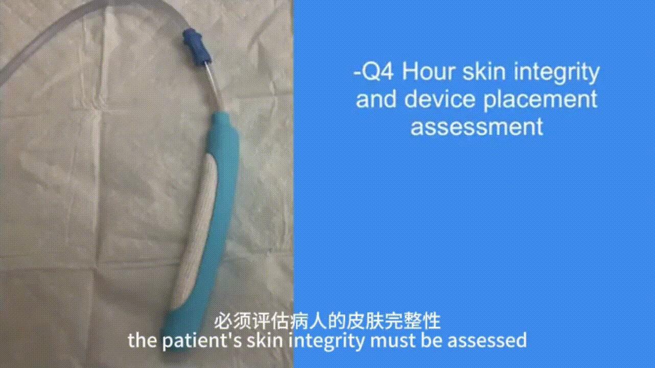 视频有点长，介绍一种新的解决方案