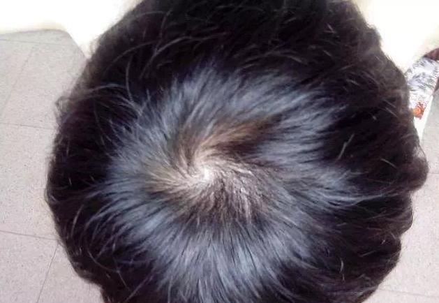 孩子头上的旋有什么含义,孩子头上的旋代表着什么