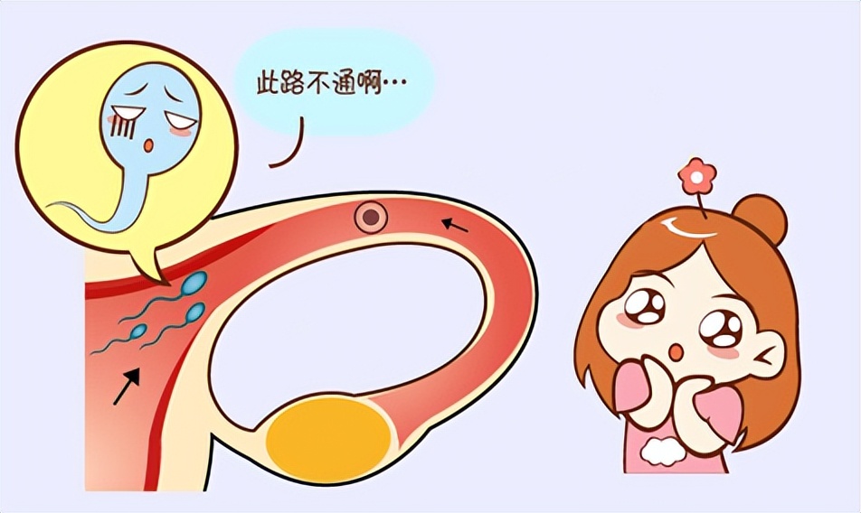 妇科病严重也怀孕了有影响吗,女性哪些妇科病会导致不孕