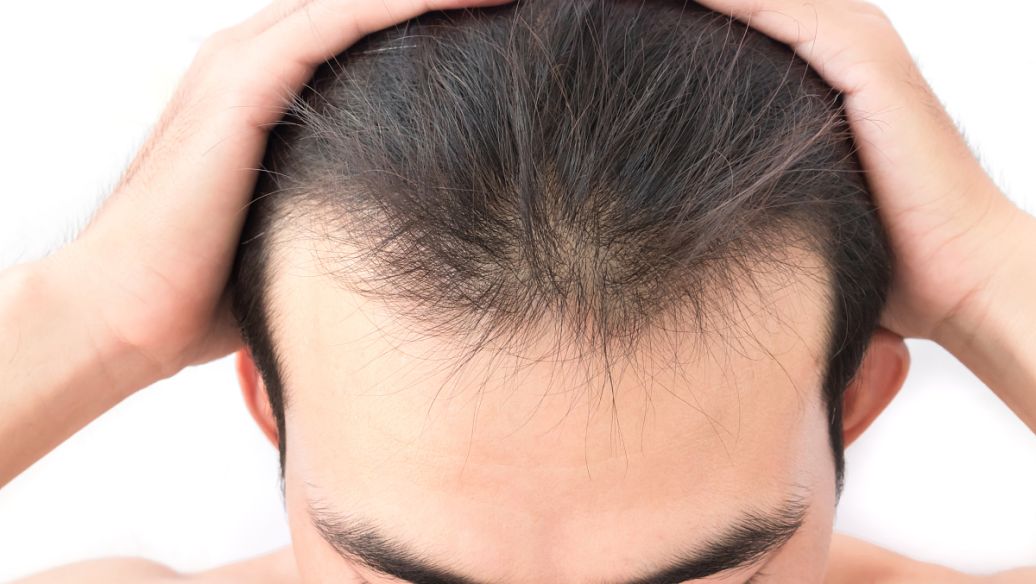 女性经常掉头发怎么回事,经常掉头发是怎么回事