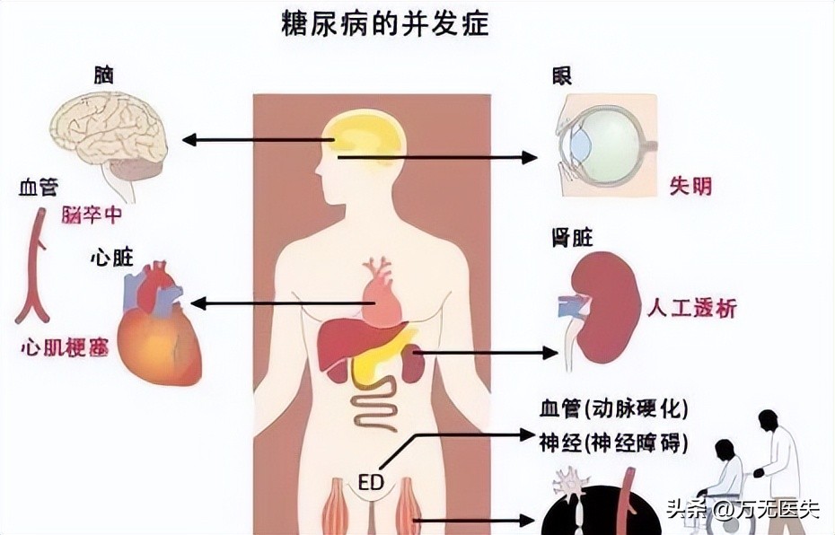 常吃冷饭降血脂吗,经常吃冷饭对人体有害吗