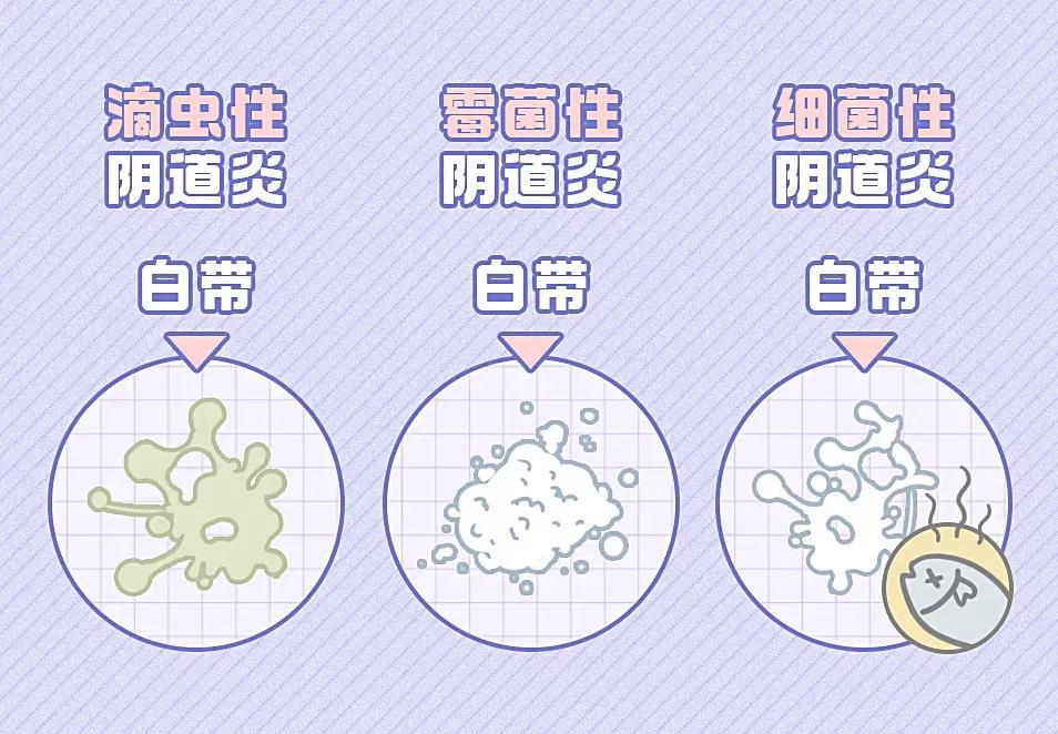 女生体下有异味正常吗,女生体下有异味