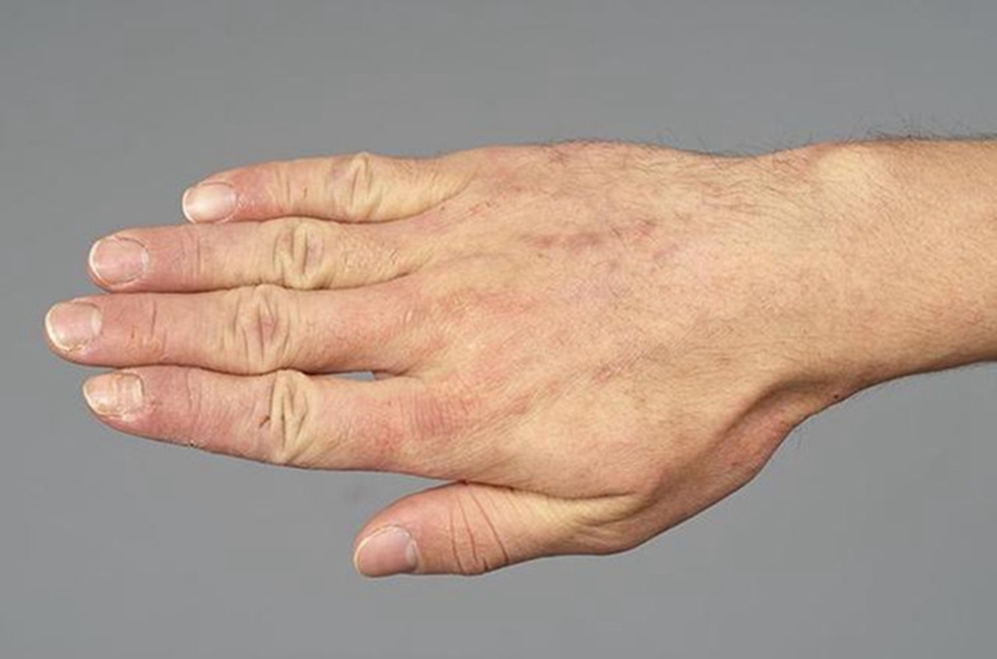 皮肤科常见10种皮肤病,女性常见8种皮肤病