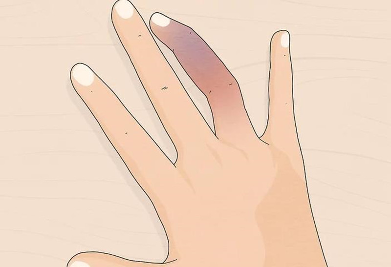 脚踝骨折和脚趾骨折怎样做康复,手腕骨折和脚踝骨折哪个严重