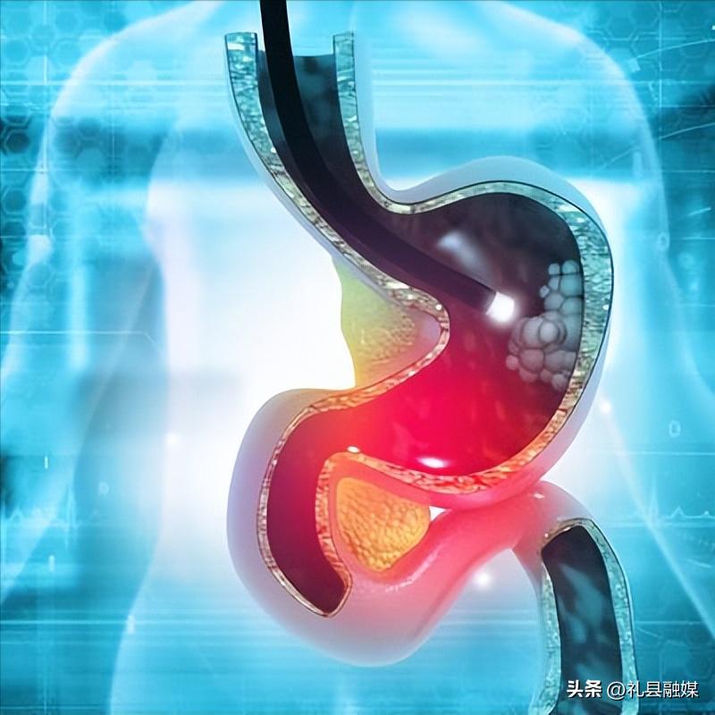 早上起来嘴巴又干又苦又臭怎么办,嘴巴苦臭是身体哪个部位出现问题