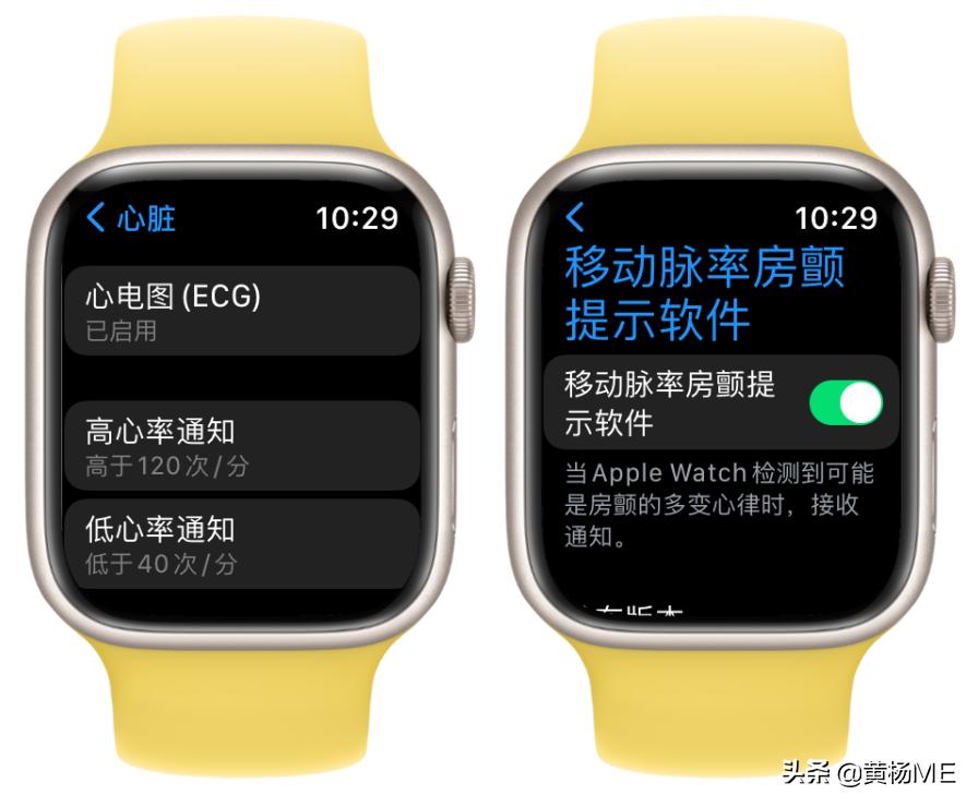 写给妈妈们看的AppleWatch功能指南