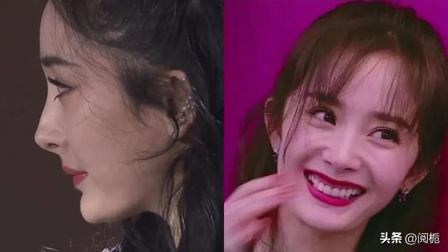 靠换脸逆天改命的六位女星,长得歪瓜裂枣整得美若天仙的明星