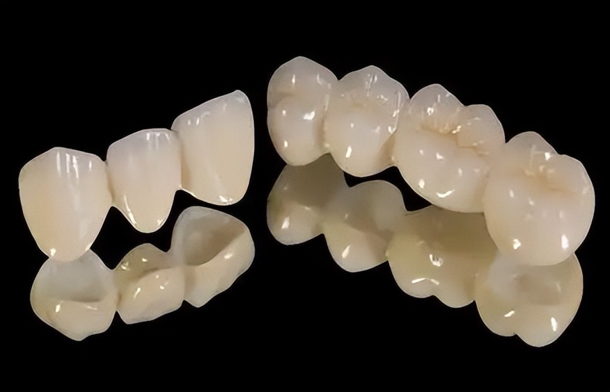 没有牙根怎么做烤瓷牙,做烤瓷牙后悔了有补救办法吗