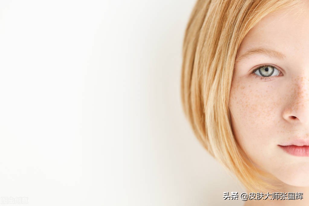 色斑严重怎么调理淡化色斑,怎么样分别表皮色斑还是真皮色斑