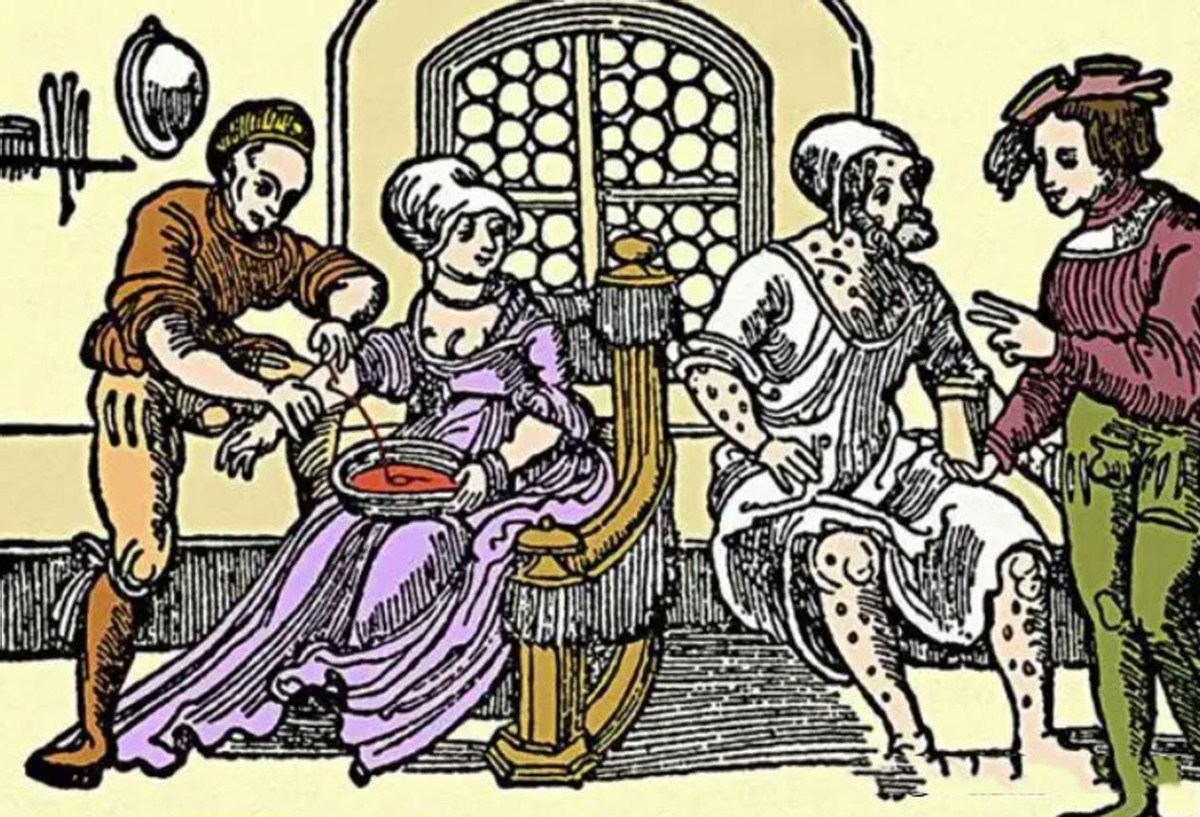 水银为什么能治疗梅毒,中世纪水银治疗梅毒