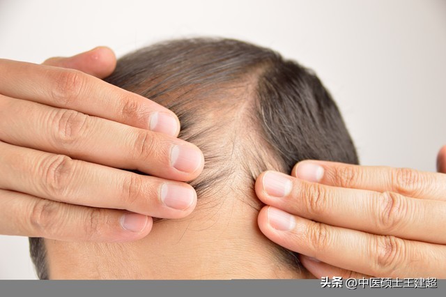 脱发严重，再也不用怕！医生教你简单四招，正确搞定掉头发