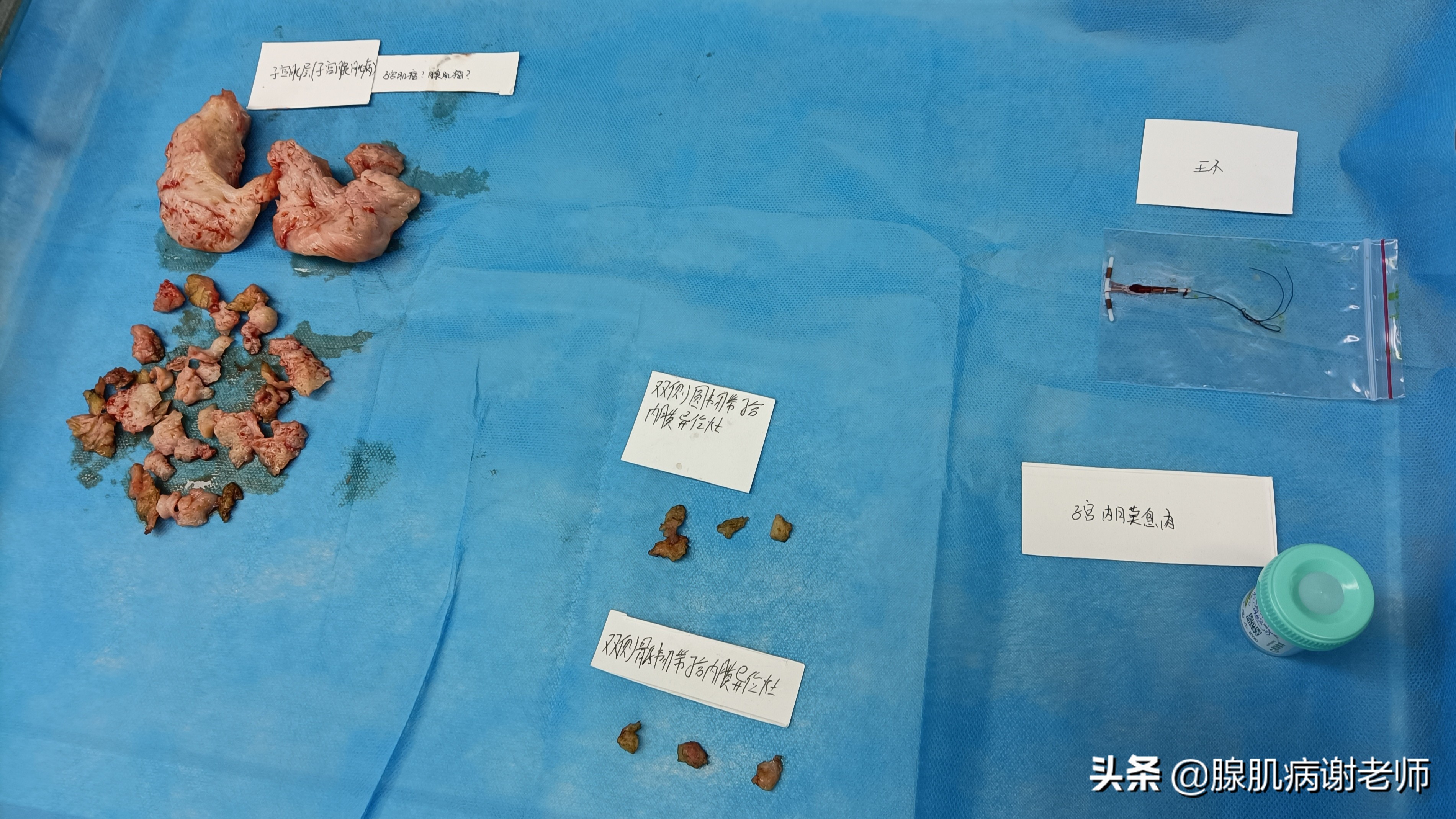 想想都难受，一个月时间体重增加10多斤，来姨妈要用卫生巾40多片