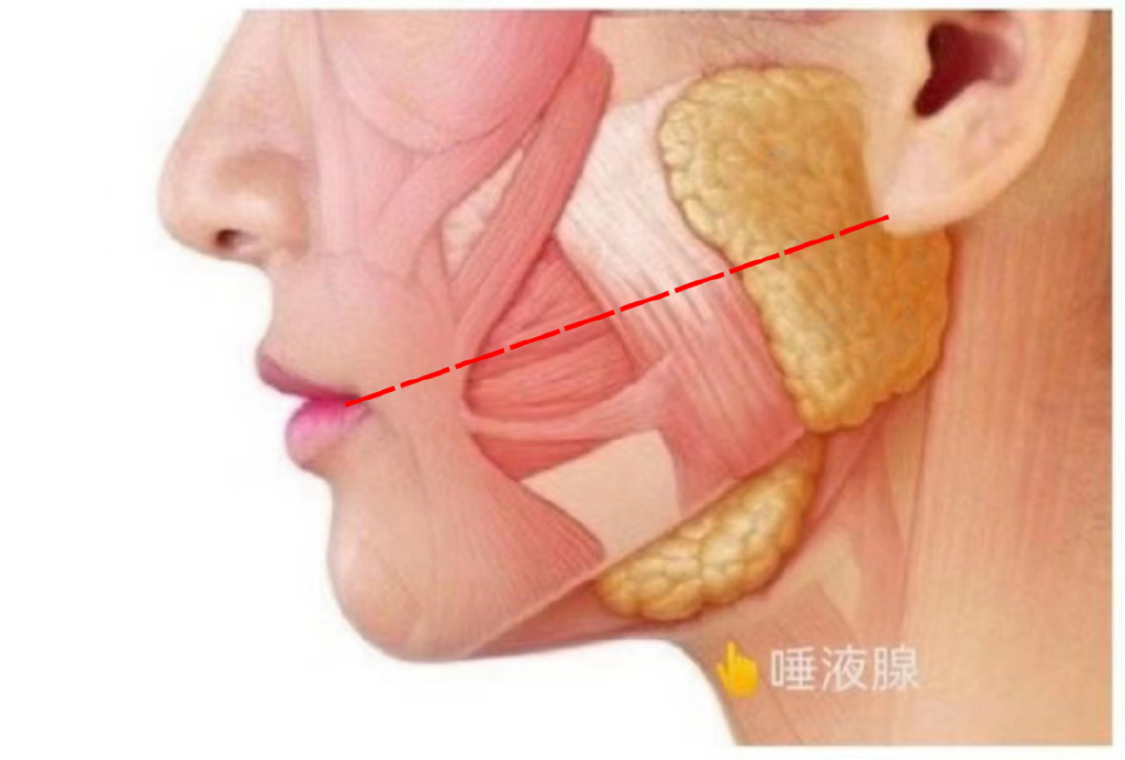 肉毒素打到腮腺,肉毒素可以打腮腺么