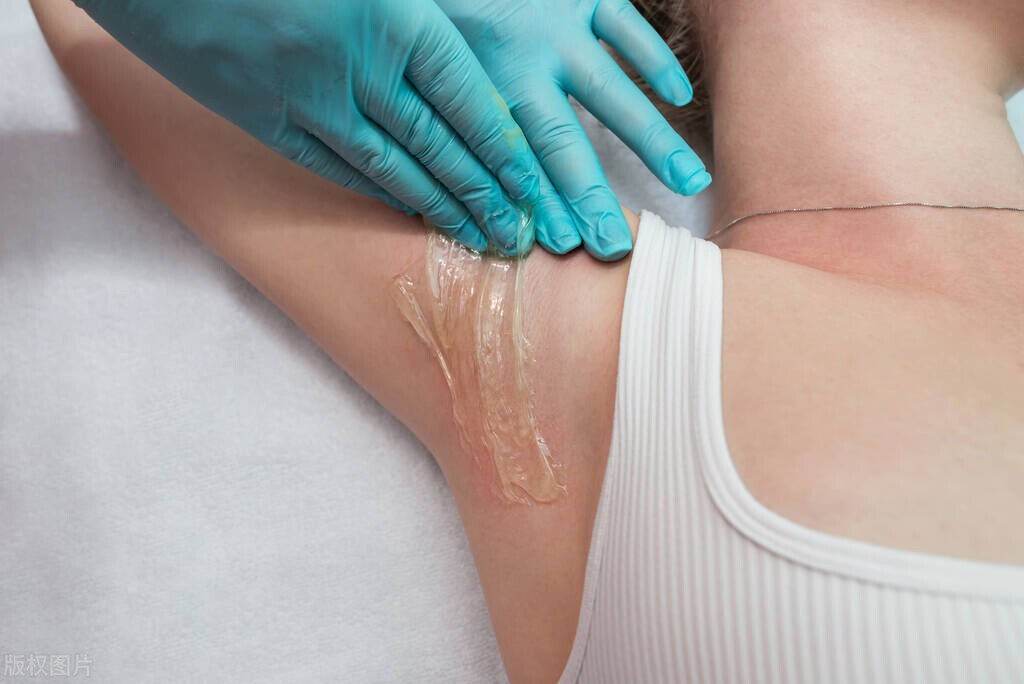 隐私部位的毛发变白,意味着体内有疾病吗?能不能刮掉?