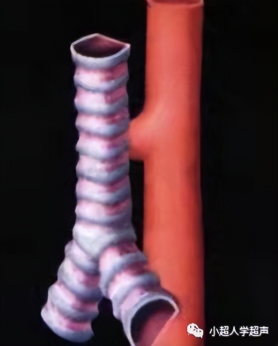 超声影像小视频,食道闭锁超声表现