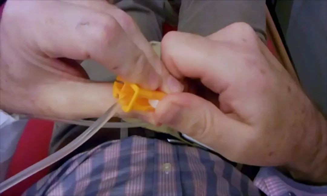 “安乐死”真的没有痛苦吗？让绝症患者解脱，但痛苦程度超出想象