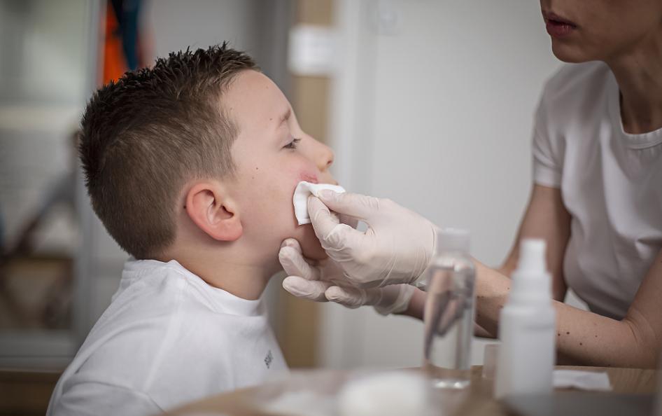 宝宝摔到头怎么处理最好,宝宝摔到头应该怎么处理涂什么药