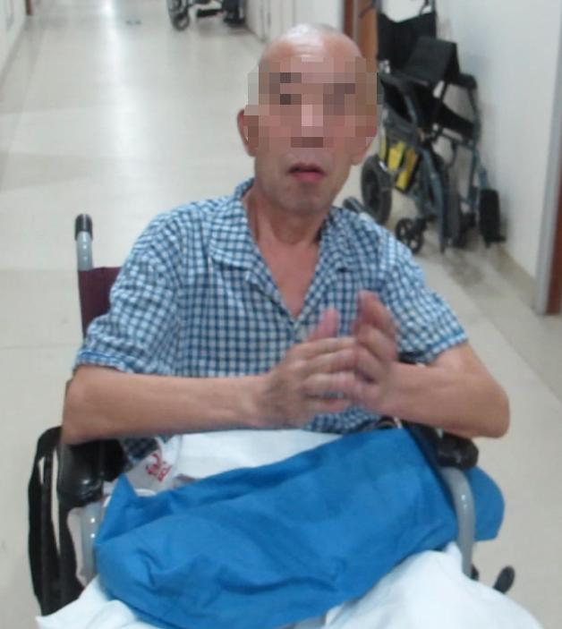 脑外伤后硬膜下积液颅骨修补,颅骨修复手术失败导致脑积水