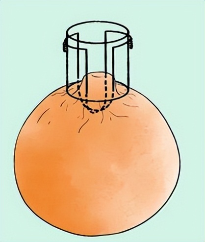 女生胸部上长了白色小点点,女生胸部长了好多小红点疙瘩