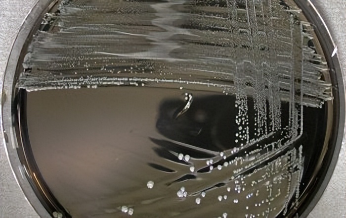 拟杆菌属重要菌种——Bacteroidesuniformis，控制好其稳态很重要