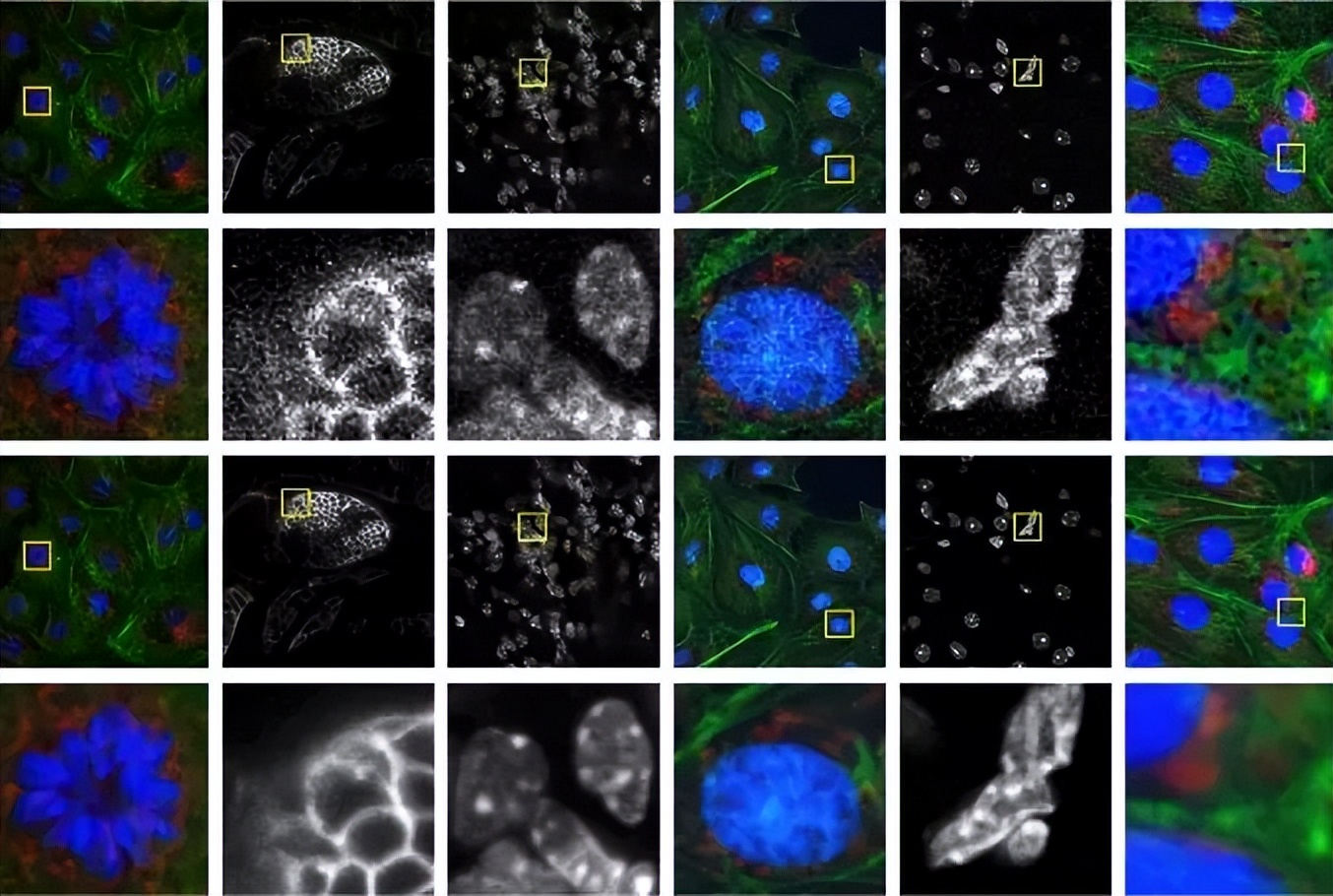 医学影像目标检测框架,开源数据集目标检测