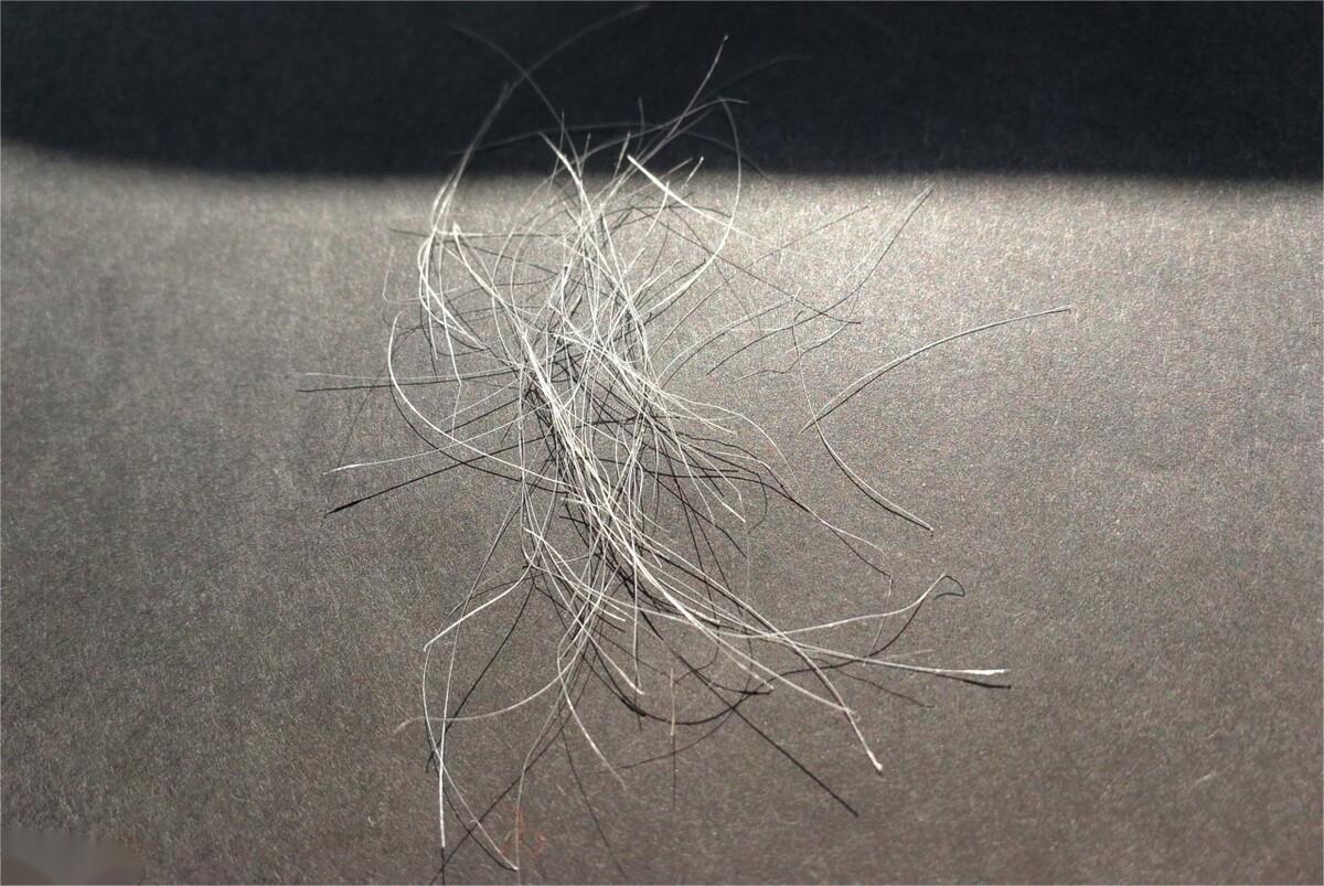 阴毛有什么用？可以刮掉吗？阴毛变白暗示了什么？