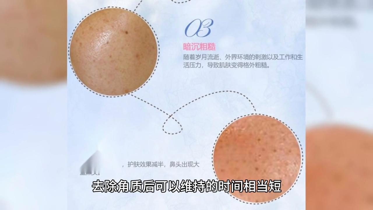 皮肤毛孔粗大发黄如何改善,皮肤发黄长痘痘毛孔粗大