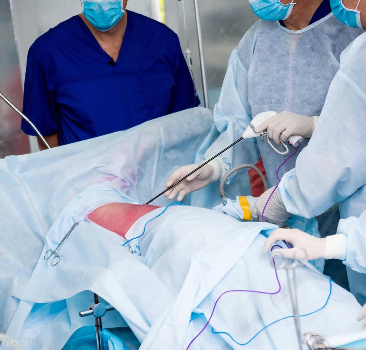 公公得了肺癌一家人还能高兴了吗,公公患癌症去世了