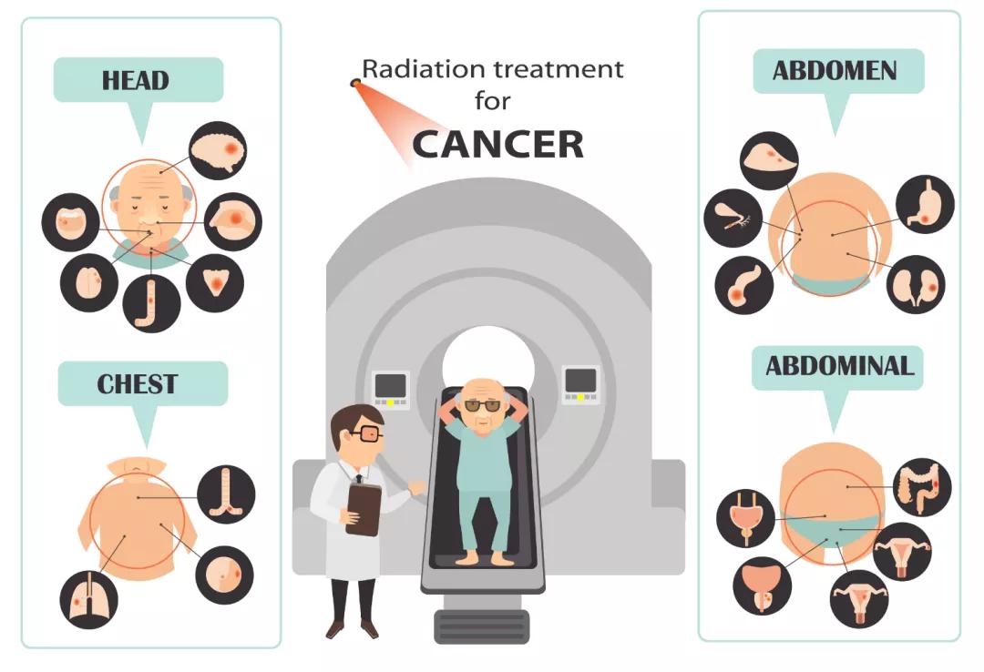 接受放疗的病人有放射性吗,做放疗的病人对周围的人有辐射么