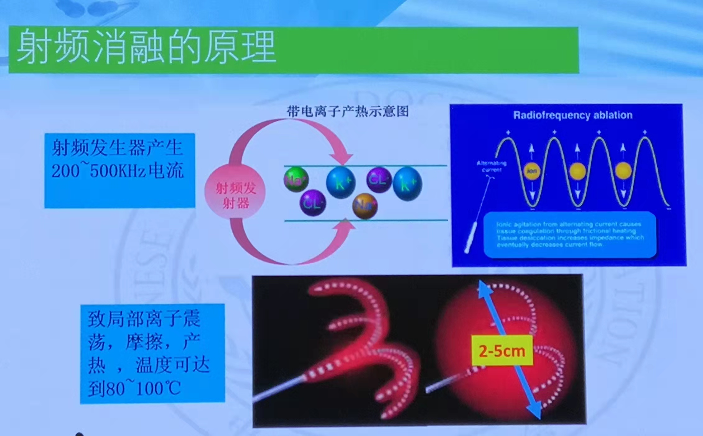 肠癌肝转移先做化疗还是介入,肠癌肝转移介入治疗哪里做得好