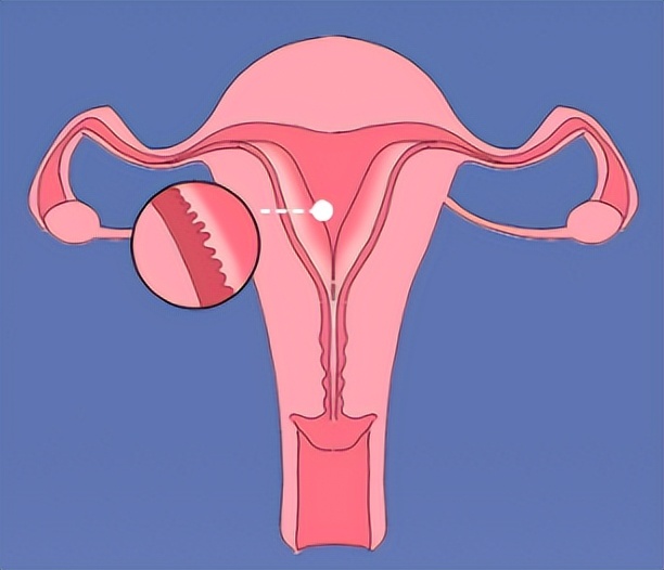 女子每月痛经,女性痛经5年加重