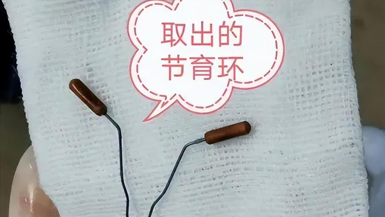 女性取出节育环后多久可以怀孕,节育环在体内有年限吗