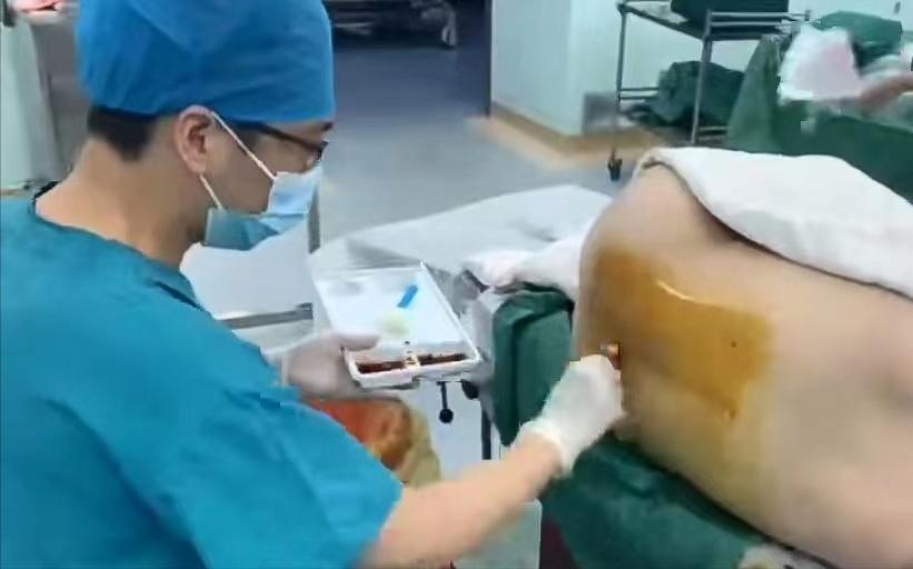 舒适医疗之分娩镇痛,医务人员对分娩镇痛的了解