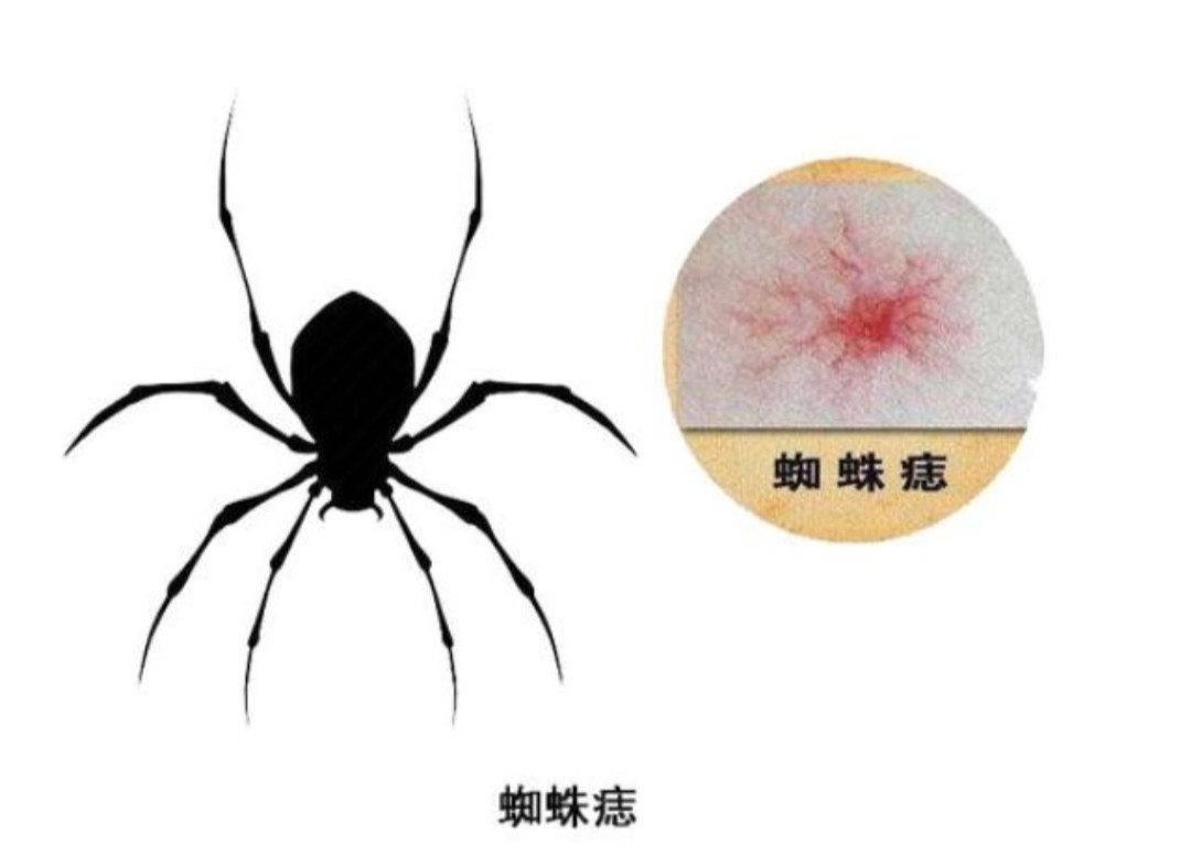 身上出现了大面积小红点不痛不痒,身上出现小红点不痛不痒什么原因