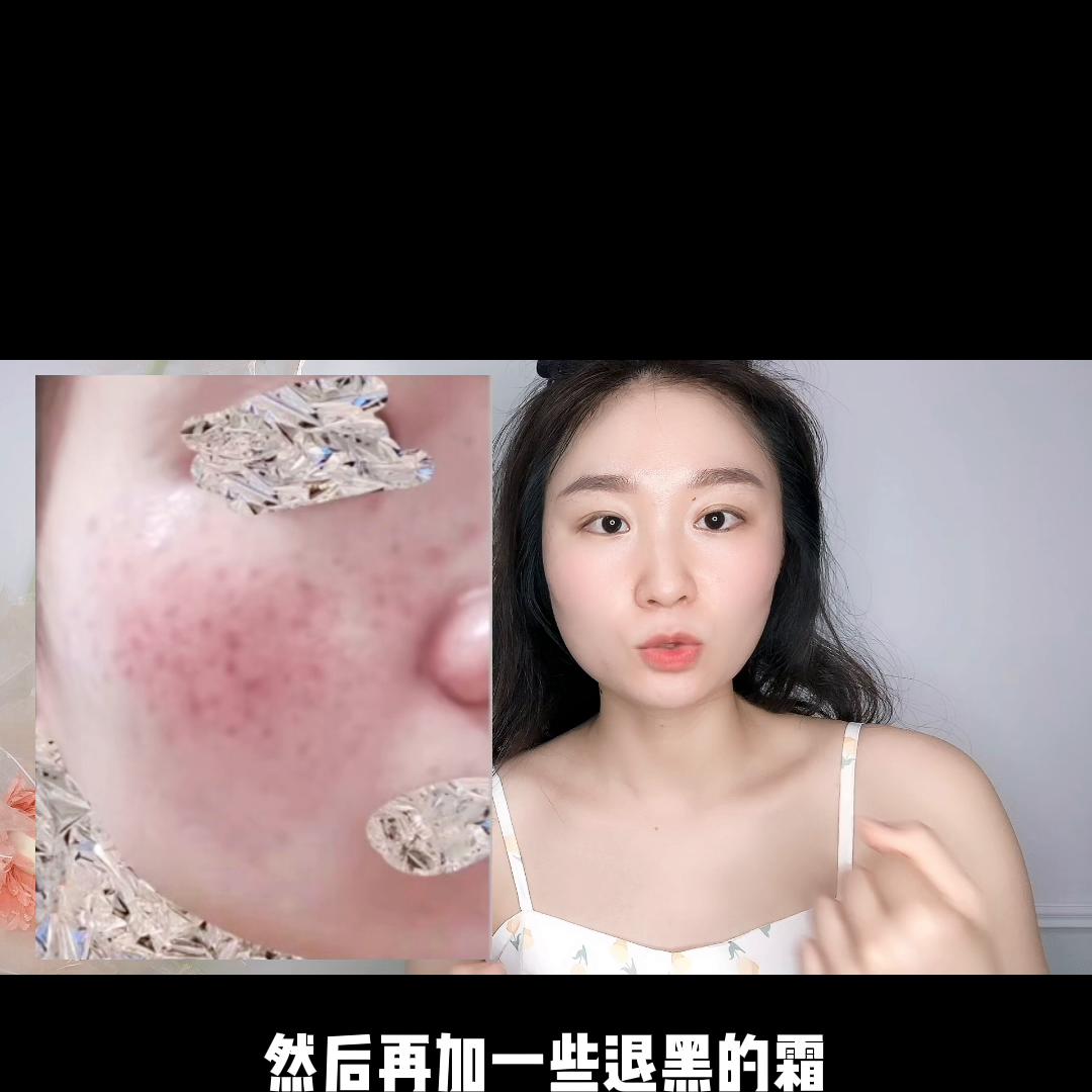 斑掉了有红印子可以护肤吗,激光点痣掉痂后红印子可以护肤吗