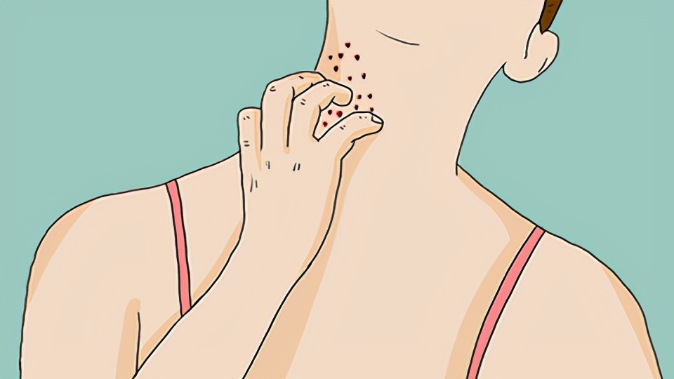 冬天皮肤干燥瘙痒怎么办用什么药,小孩冬天皮肤干燥瘙痒是什么原因