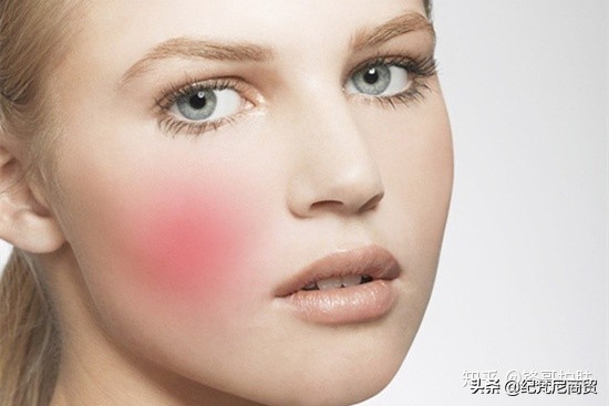 脸皮肤敏感遇热发红怎么办,皮肤敏感脸蛋泛红是什么原因