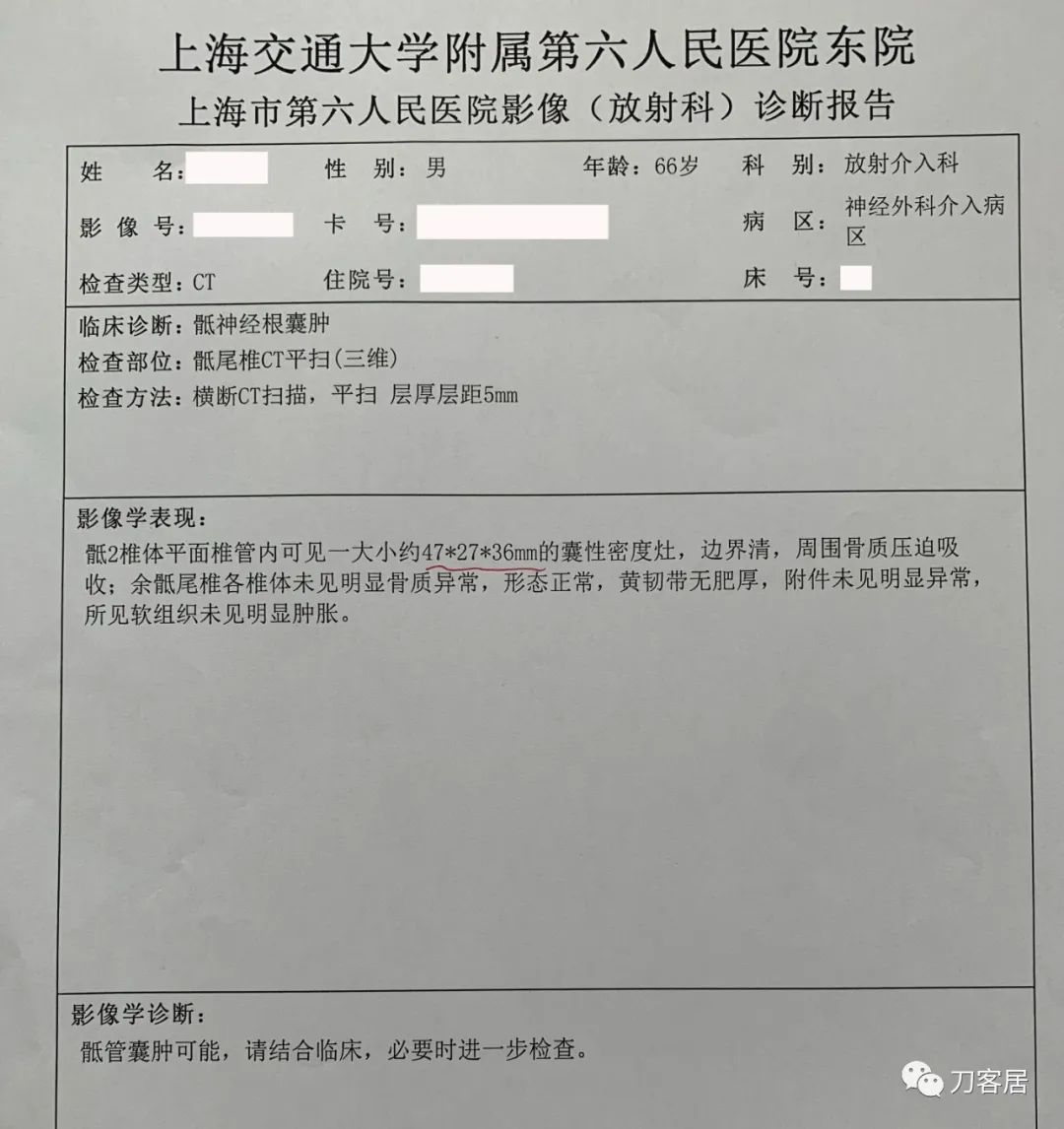 又是颈椎病，又是腰椎滑脱，又是骶管囊肿，多家医院就诊...