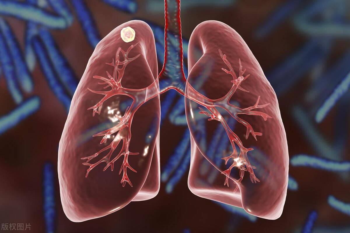 半个月了还是咳嗽，到底要不要去打抗生素？医生：看情况来决定