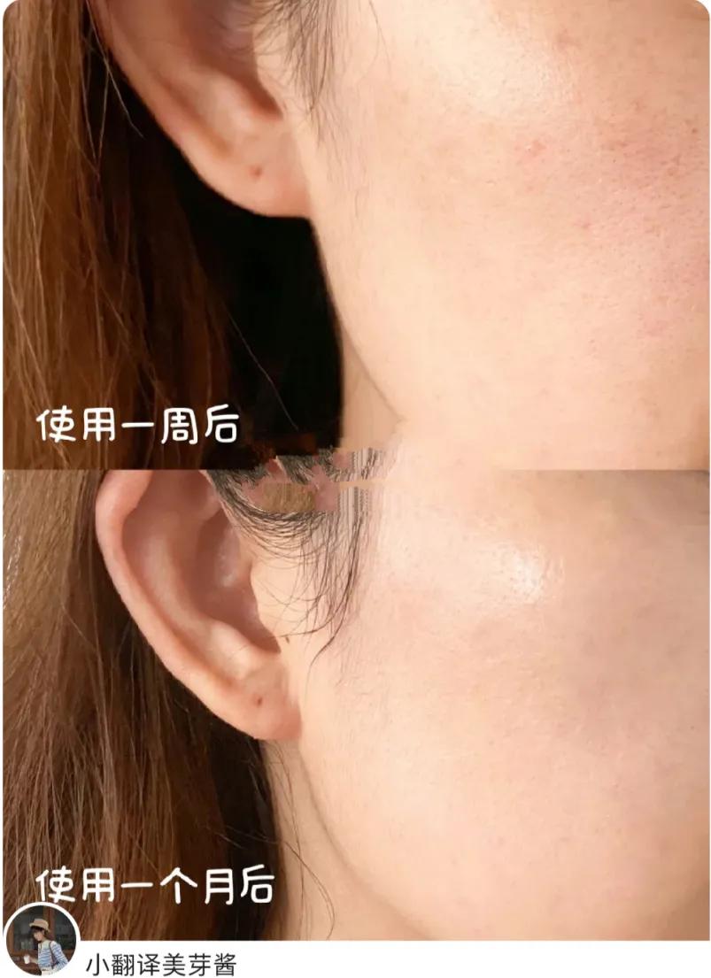 夏季应该怎么美白,夏季如何做好美白