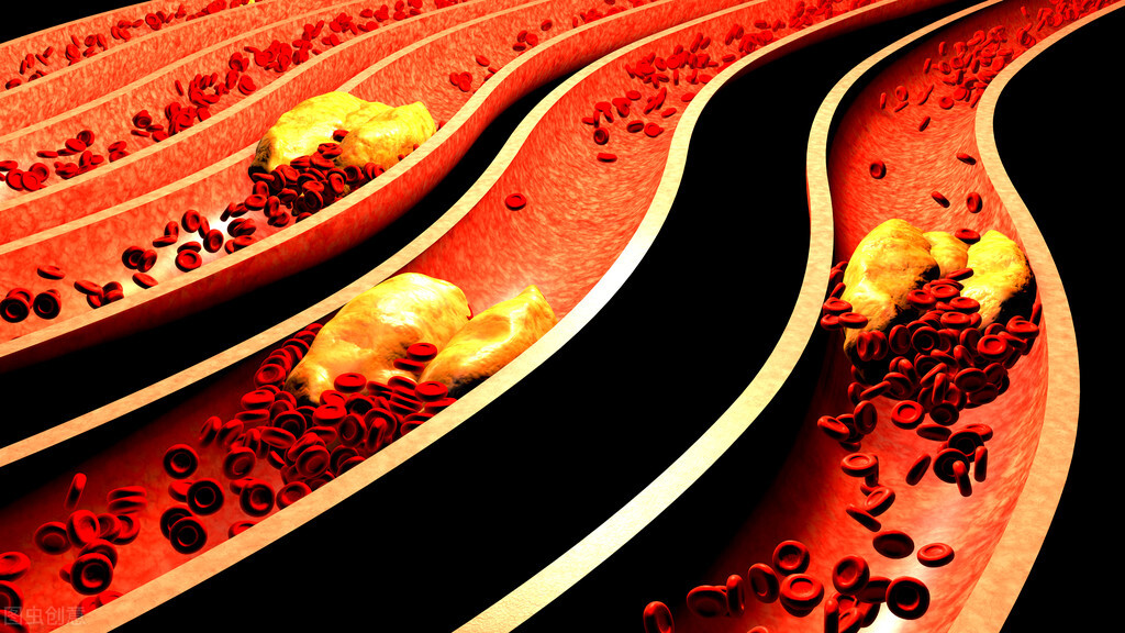 血管为什么会发生痉挛,血管硬化最佳锻炼方法
