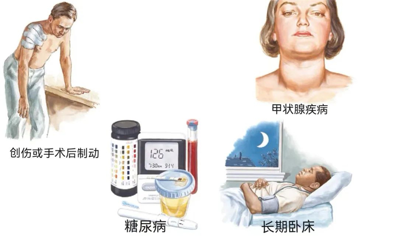 秦皇岛军工医院运动医学门诊医生带您了解“肩周炎”