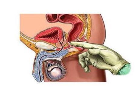 别尴尬！“一阳指”是项正经且重要的检查，作用不可小觑